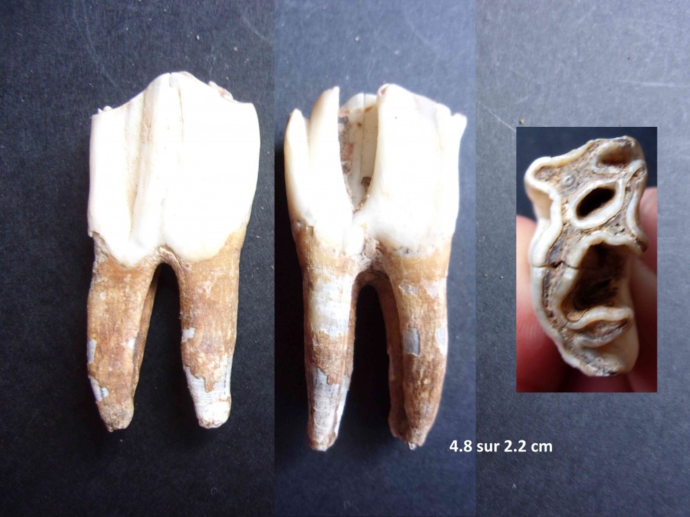 denta7.JPG